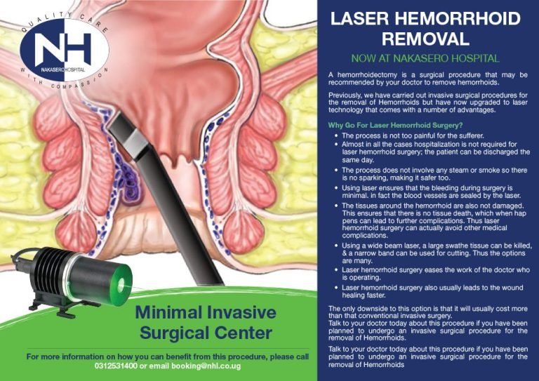 雷射痔瘡消融手術 (The laser hemorrhoidectomy)