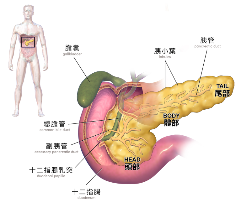 胰臟癌早期症狀不明顯 50歲患糖尿病等3族群當心