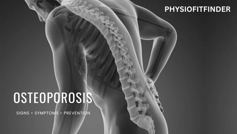 骨質疏鬆症(Osteoporosis)