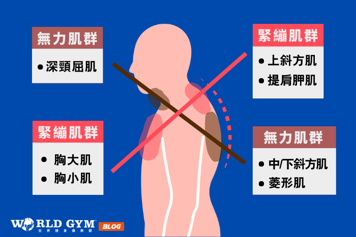 吃飯愛低頭滑手機 上交叉症候群胃食道逆流纏身